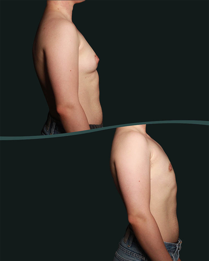 1_0002_3 Side (1).webp